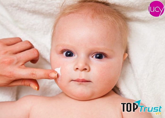 Loại kem bôi nẻ trẻ em tốt nhất
