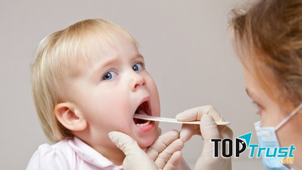 Mẹo hay chữa viêm họng bằng thảo dược