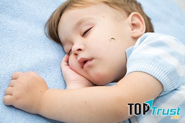 Mẹo vặt trị muỗi đốt hiệu quả cho trẻ sơ sinh