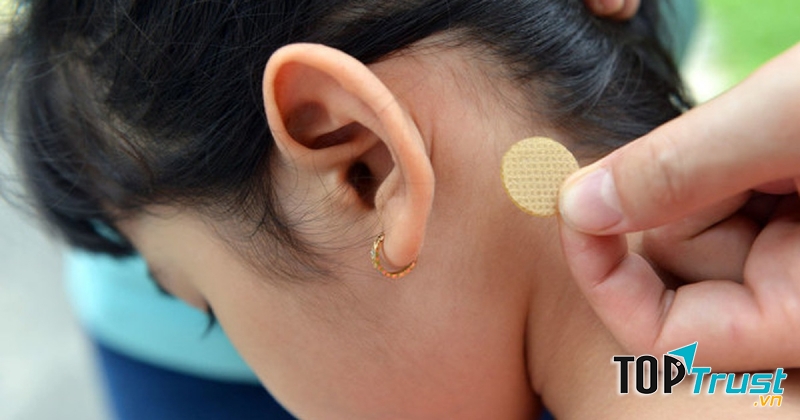 Miếng dán chống say tàu xe hiệu quả, được tin dùng hiện nay