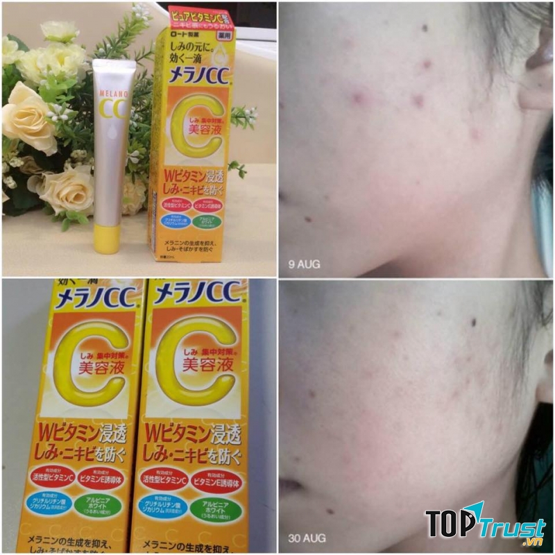 Mỹ phẩm nội địa Nhật được ưa chuộng nhất tại Việt Nam