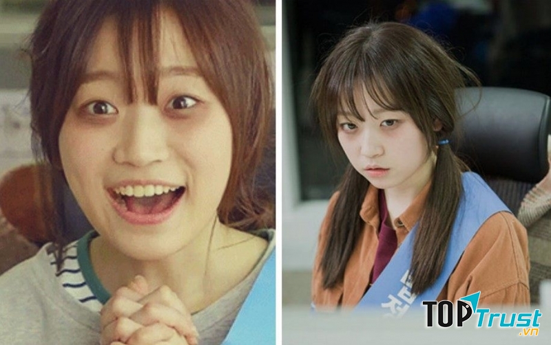 Nguyên nhân gây quầng thâm mắt có thể bạn chưa biết