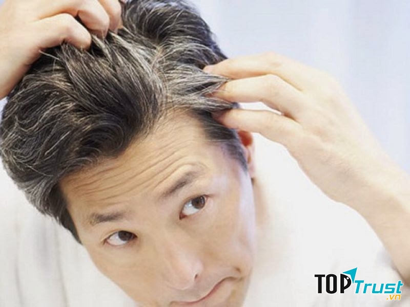 Nguyên nhân khiến đầu bạn có nhiều tóc bạc