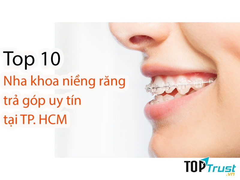 Nha khoa niềng răng trả góp uy tín nhất TP. HCM