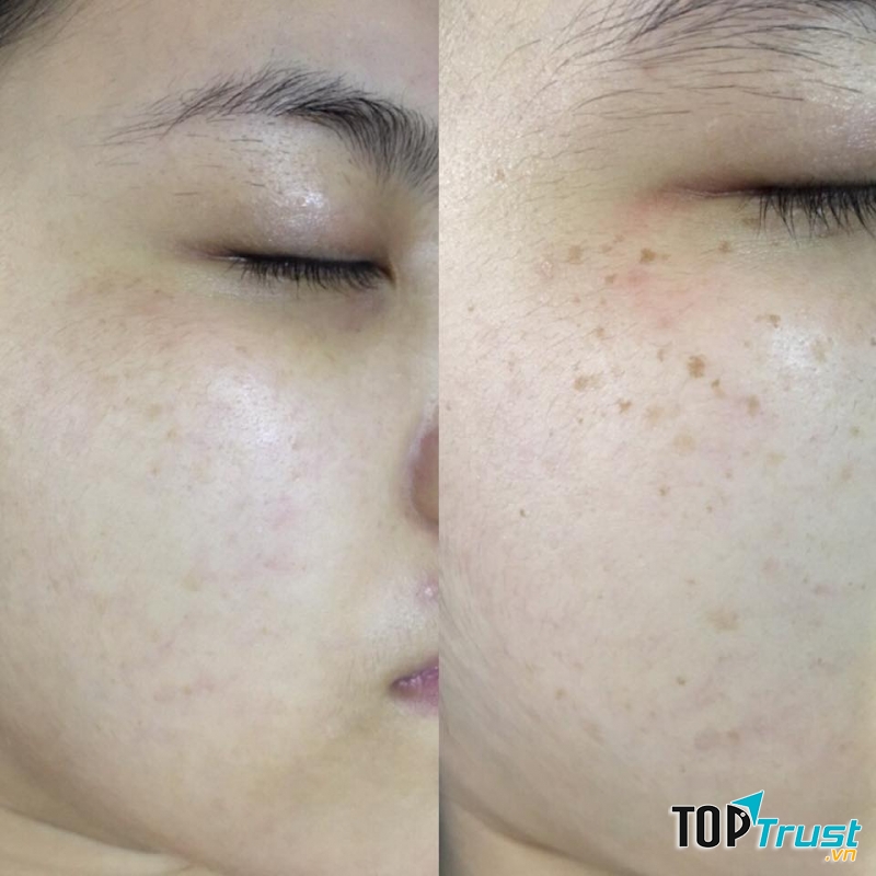 Phòng khám da liễu uy tín nhất TP. Biên Hòa, Đồng Nai