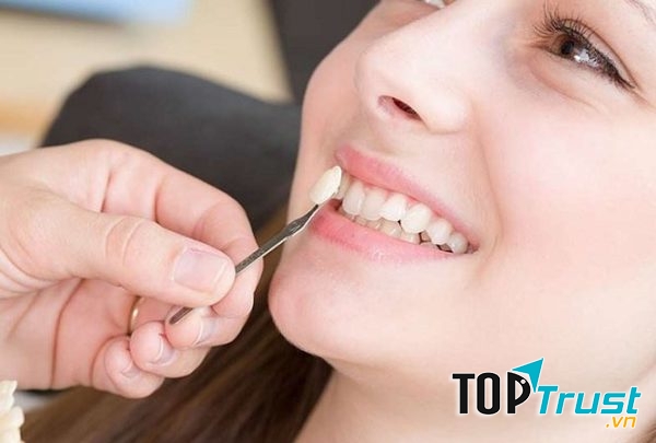 Phòng khám nha khoa tốt nhất quận 11, Tp HCM