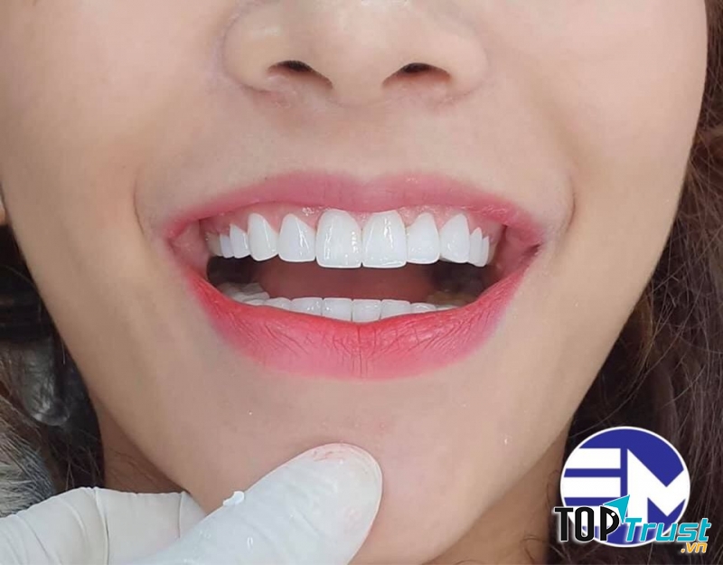 Phòng khám nha khoa uy tín nhất Bạc Liêu