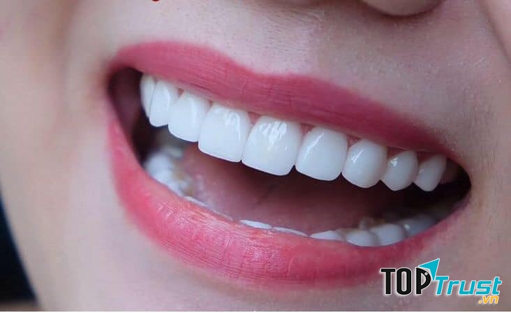 Phòng khám nha khoa uy tín nhất Phú Quốc