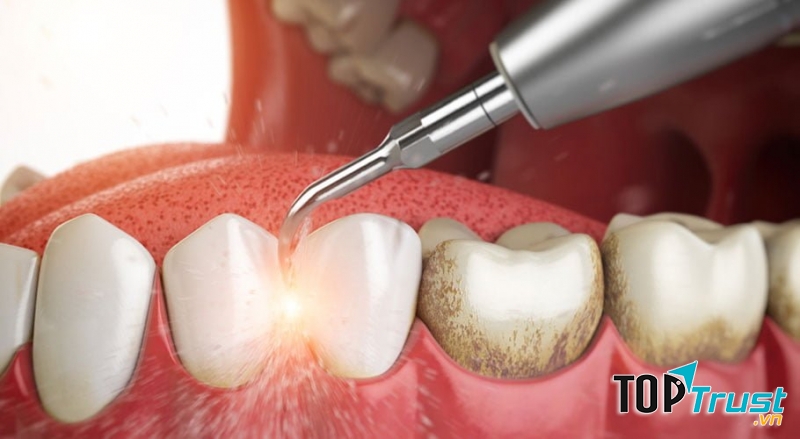 Phòng khám nha khoa uy tín nhất quận 6, TP. HCM