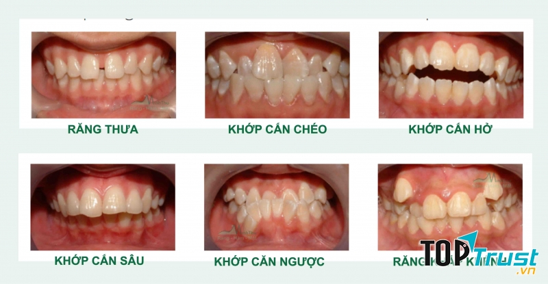 Phòng khám nha khoa uy tín nhất quận Tây Hồ, Hà Nội