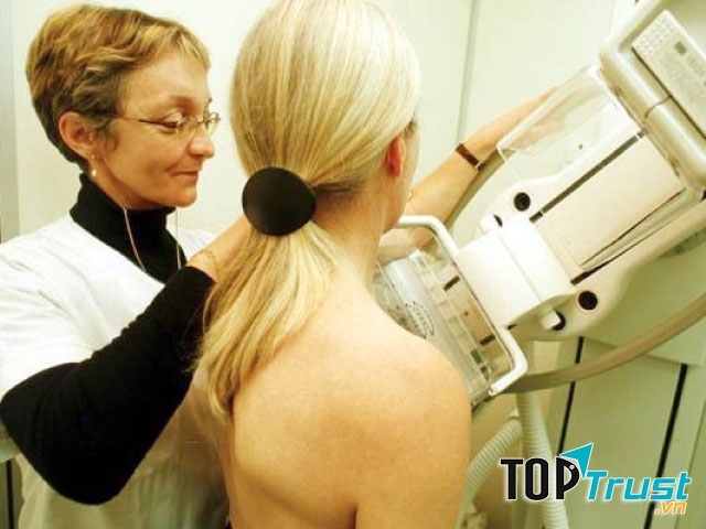 Phương pháp ngăn ngừa ung thư vú hiệu quả