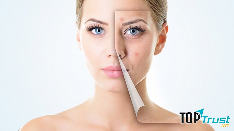 Sai lầm khi dưỡng da khiến da mãi không thể đẹp lên