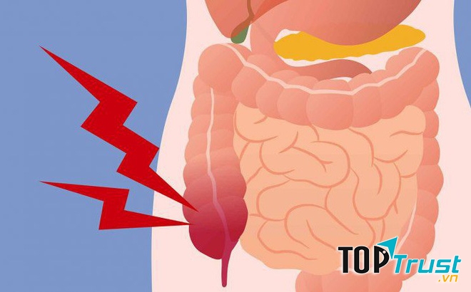 Sản phẩm giúp thải độc ruột, thanh lọc cơ thể tốt nhất