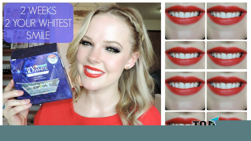 Sản phẩm làm trắng răng hiệu quả nhất