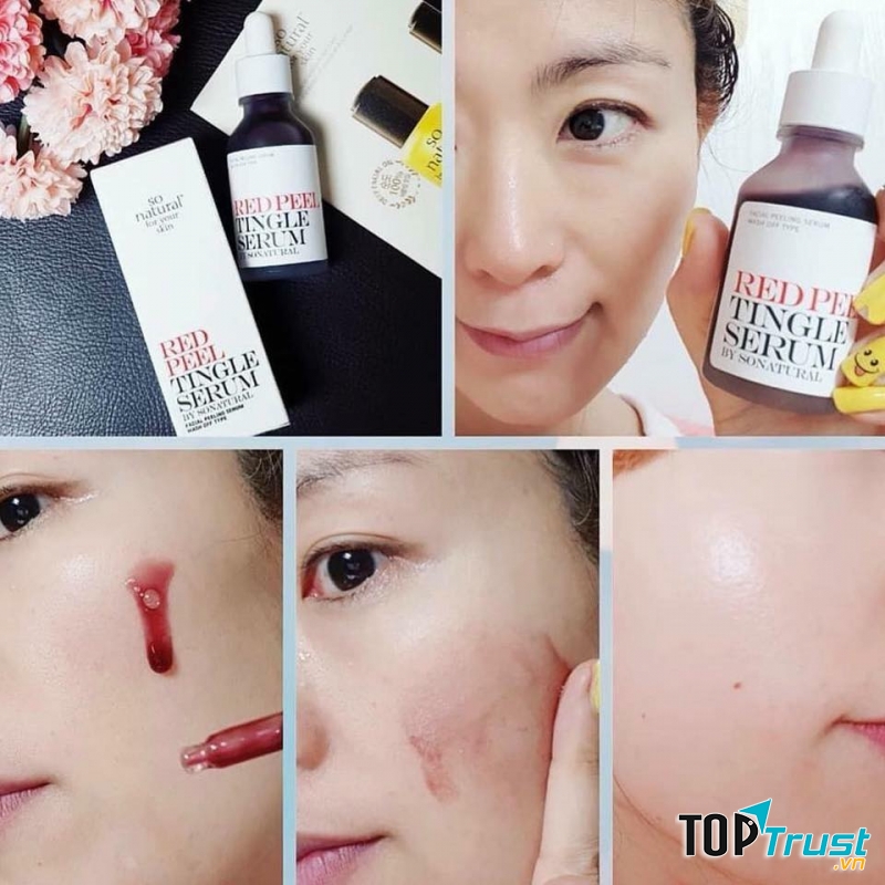 Serum tẩy tế bào chết tốt nhất hiện nay