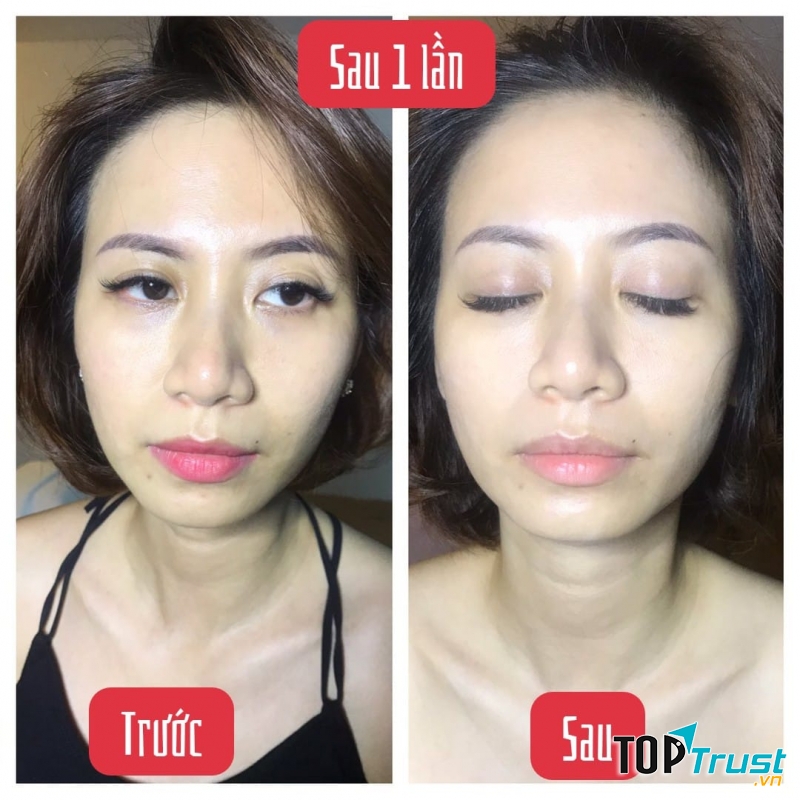 Spa chăm sóc da mặt tốt nhất tại quận 3, TP. HCM