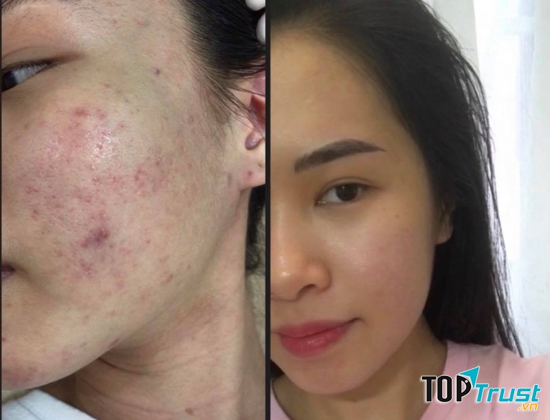 Spa chăm sóc da tốt nhất Hải Phòng