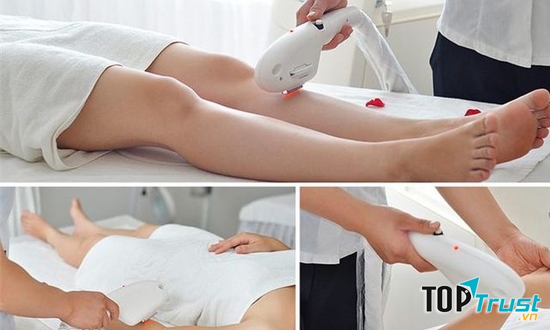 Spa có dịch vụ triệt lông chất lượng nhất Hà Nội