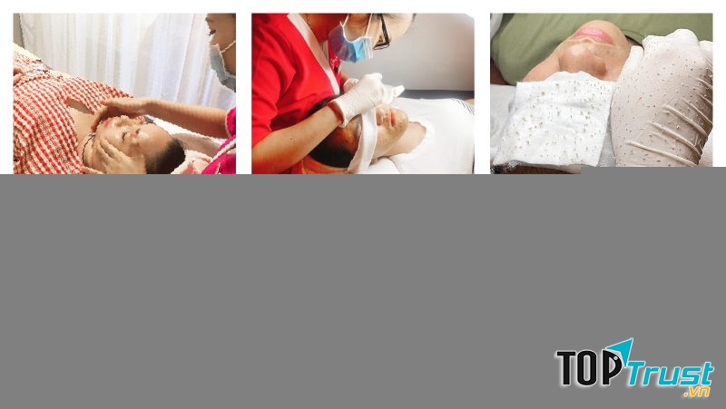 Spa trị mụn hiệu quả nhất Bến Tre