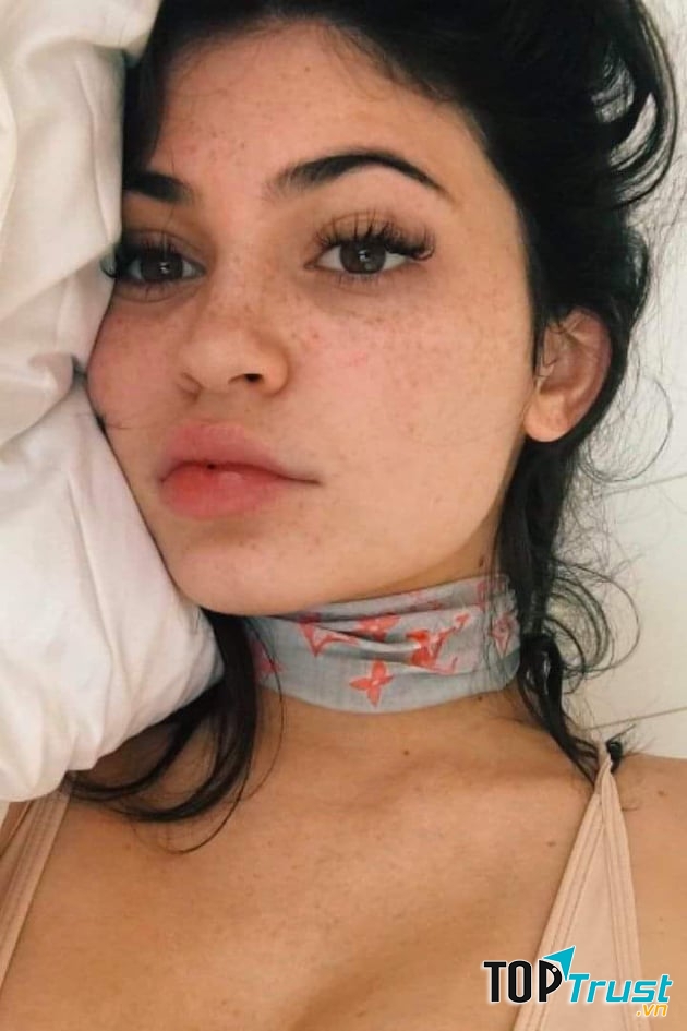 Spa trị nám tốt nhất Đà Lạt