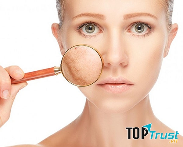 Spa trị nám tốt nhất TP. Vinh, Nghệ An