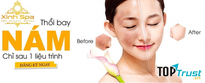 Spa trị nám tốt nhất Vũng Tàu