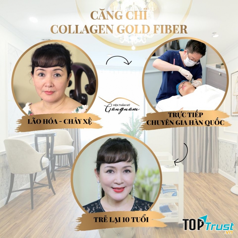 Thẩm mỹ viện Căng da mặt bằng chỉ Collagen tốt nhất Việt Nam
