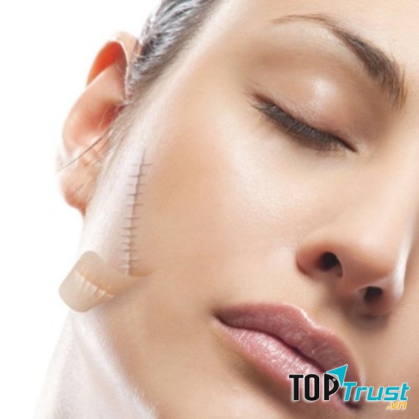 Thẩm mỹ viện trị sẹo lồi hiệu quả, uy tín hàng đầu tại Hà Nội