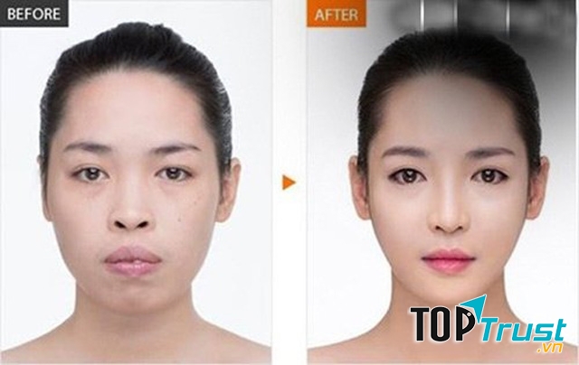 Thẩm mỹ viện uy tín tại miền Bắc