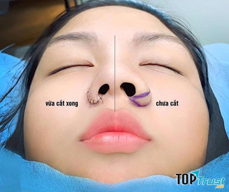 Thẩm mỹ viện uy tín và chất lượng nhất Hà Tĩnh