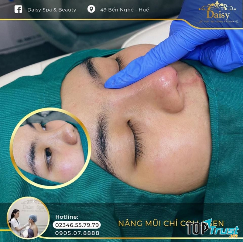 Thẩm mỹ viện uy tín và chất lượng nhất Huế