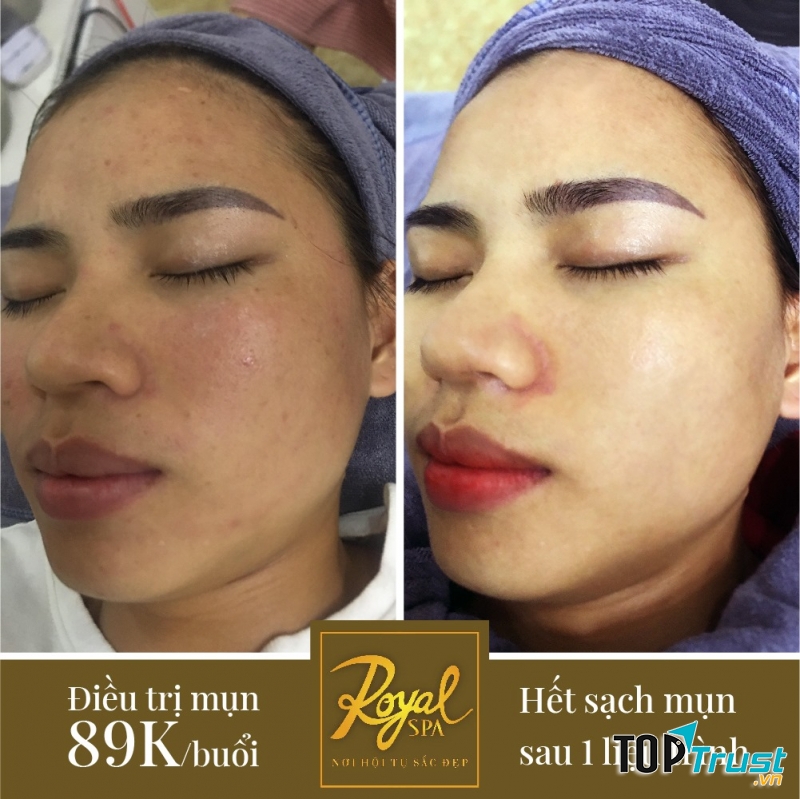 Thẩm mỹ viện uy tín và chất lượng nhất Ninh Bình