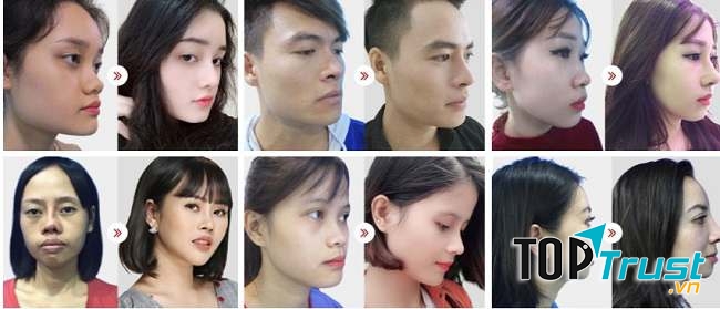 Thẩm mỹ viện uy tín và chất lượng nhất quận Đống Đa, Hà Nội