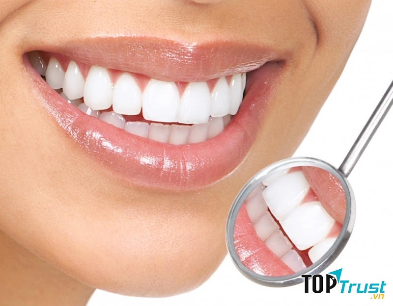 Thói quen gây hại cho răng của bạn