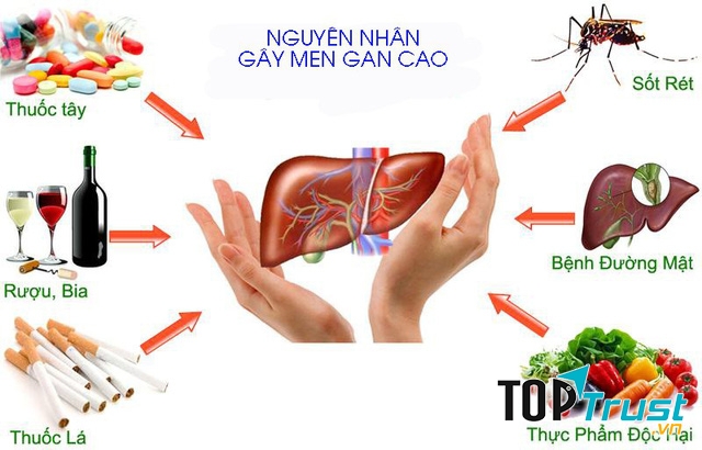 Thực phẩm chức năng hỗ trợ điều trị men gan cao