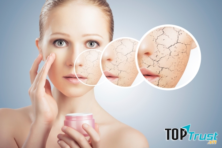 Thực phẩm tốt nhất cho cô nàng da khô