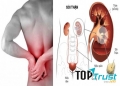 Công thức thần kì đánh bay sỏi thận không lo tái phát