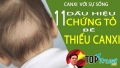 Dấu hiệu cho thấy trẻ thiếu canxi cha mẹ nên biết