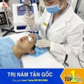 địa chỉ điều trị nám tốt nhất tại Pleiku, Gia Lai