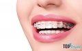 Địa chỉ niềng răng uy tín nhất quận Tân Bình, TP. HCM