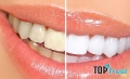 địa chỉ tẩy trắng răng hiệu quả, an toàn nhất tại Tp HCM
