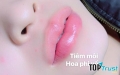 Địa chỉ tiêm filler - botox uy tín và chất lượng nhất Vũng Tàu
