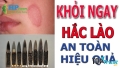 Loại thuốc trị hắc lào tốt và hiệu quả nhất