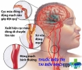 Thuốc điều trị tai biến mạch máu não hiệu quả nhất