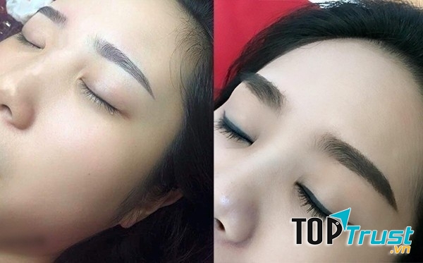 Thuốc kích thích mọc lông mày hiệu quả nhất hiện nay