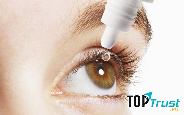 Thuốc nhỏ mắt giúp đôi mắt sáng khỏe và ngăn ngừa các bệnh về mắt tốt nhất hiện nay