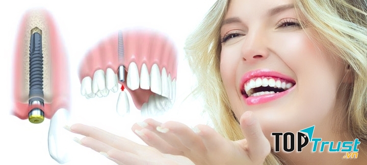 Trung tâm răng hàm mặt uy tín nhất tại Đà Nẵng