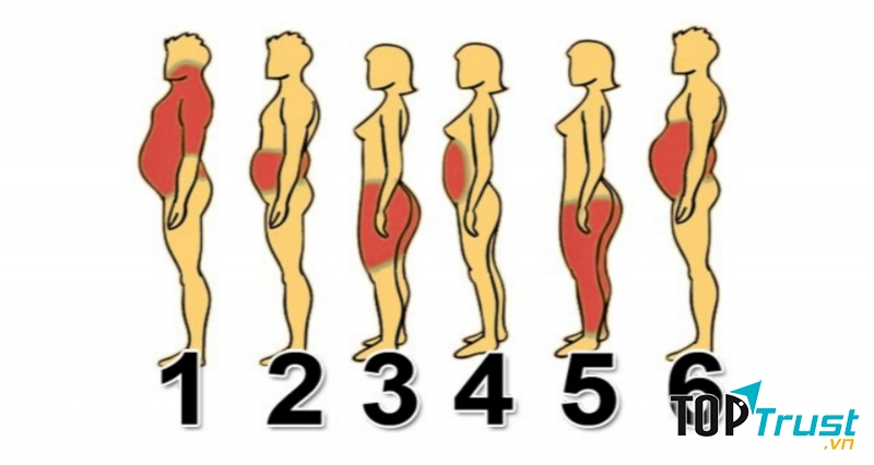 Vị trí dễ tích mỡ trên cơ thể và cách giải quyết