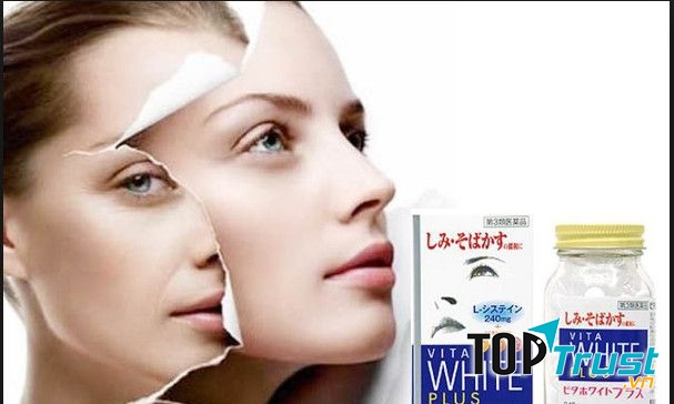 Viên uống đặc trị nám, tàn nhang hiệu quả nhất hiện nay