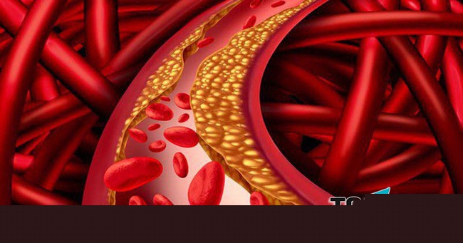 Viên uống giảm mỡ máu hiệu quả nhất hiện nay